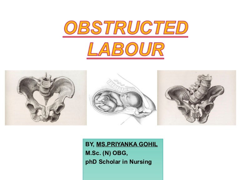 definition of precipitate labour definition of precipitate labour