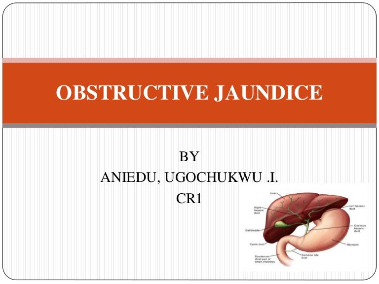 Obstructive jaundice 1