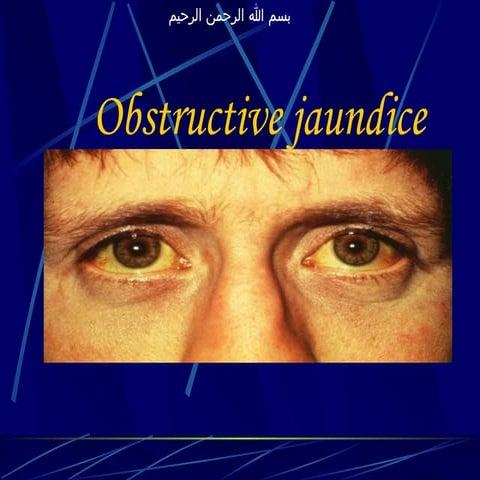 OBSTRUCTIVE JAUNDIce G.pptx and more information