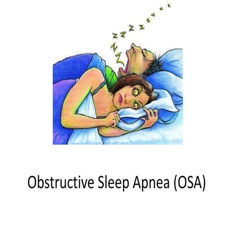 OBSTRUCTIVE SLEEP APNEA [Autosaved].pptx