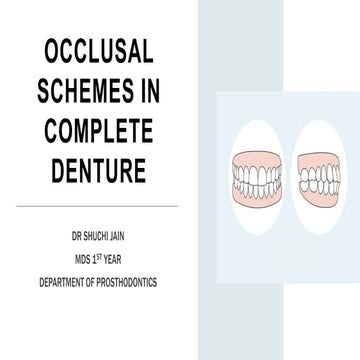 Occlusal schemes in CD_Dr Shuchi Jain.pptx