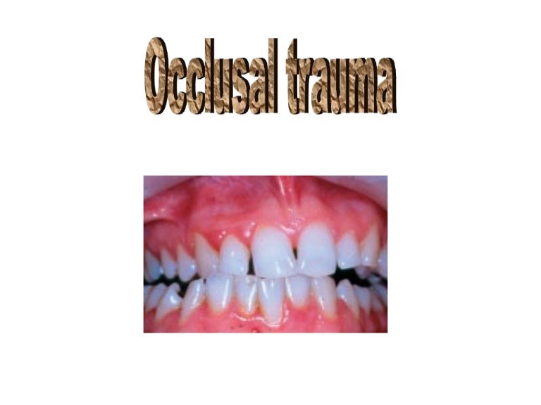 Occlusal trauma