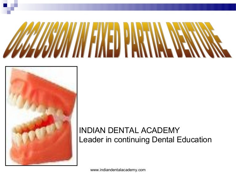 Occlusion concepts3 / dental implant courses by Indian dental academy