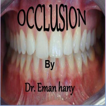 OCCLUSION | PPTX