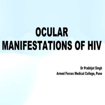 Occular manifestations in HIV AIDS .pptx