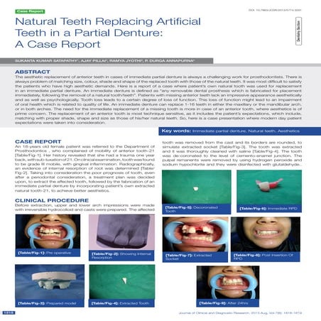 Non-metal clasp removable partial dentures using CAD CAM | PPTX
