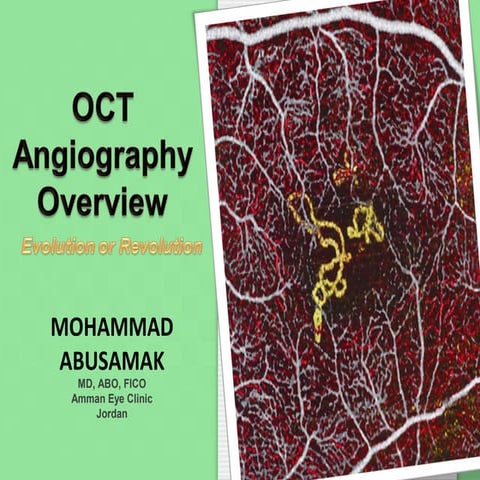 OCTA Optical Coherence Tomography angiography