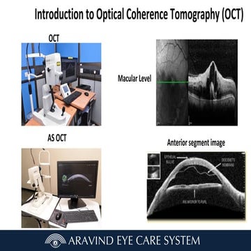 Anterior segment and Corneal OCT review | PPSX
