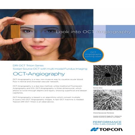 Oct angiography topcon leaflet may 2015 | PDF