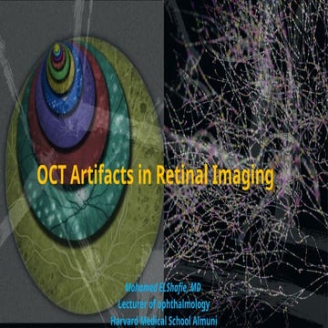 OCT Artifacts in Retinal Imaging and processing