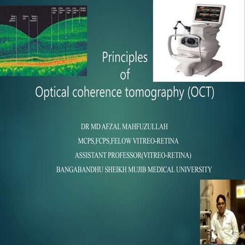 Oct(optical cohorence tomography)