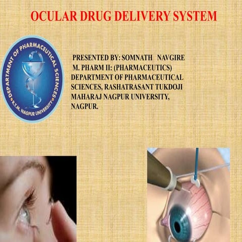 Ocular drug delivery