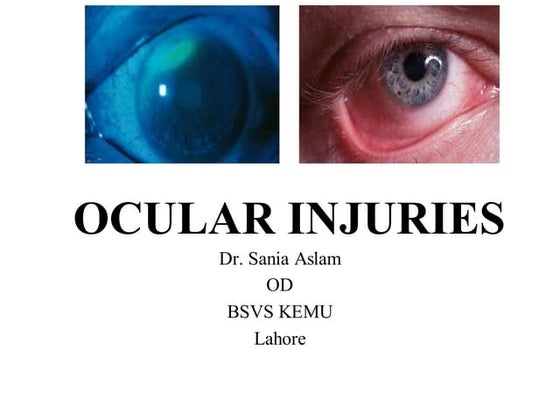 opthalmology - Injuries of organ of vision, eye..pptx