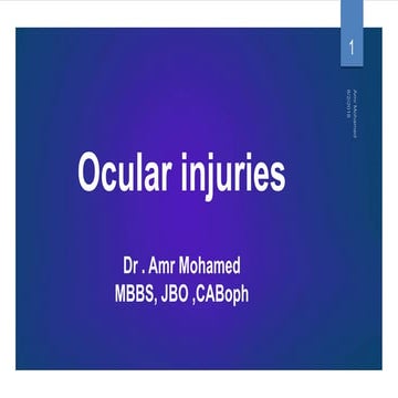 Ocular injuries for undergraduate students