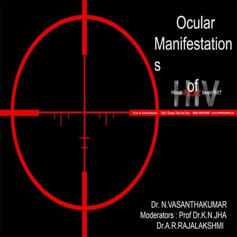 Ocular manifestations of HIV