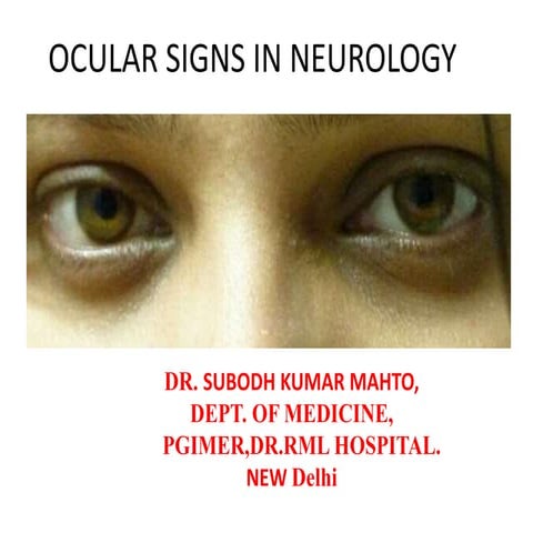 Ocular signs in medicine/ neurology