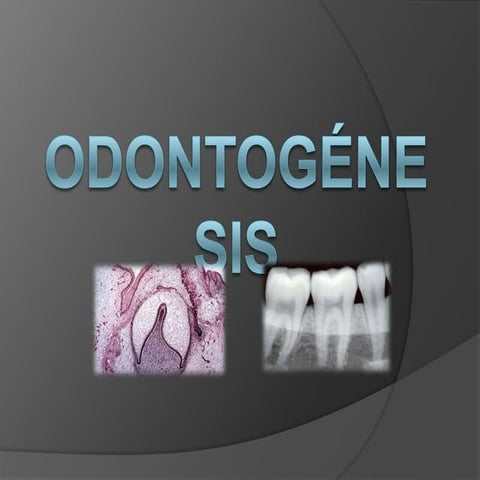  Odontogénesis 