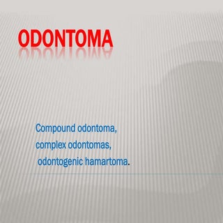 Odontoma (Doctor Faris Alabeedi MSc...