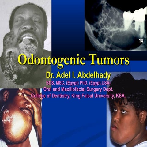 Odontogenic Tumors