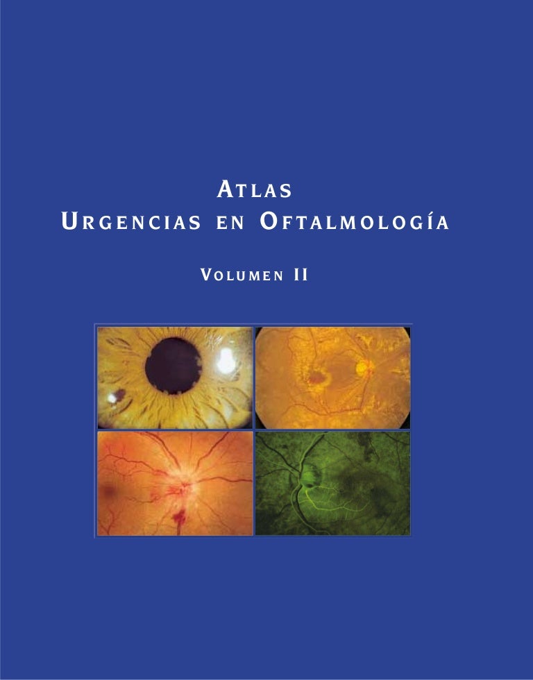 síntomas de diabetes de la vitritis