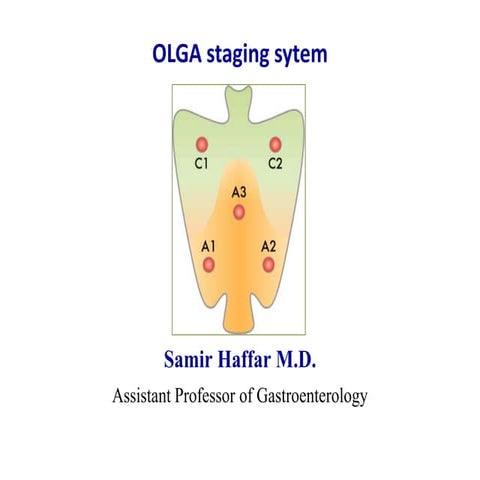 Olga staging system for diagnosis of gastritis | PPTX