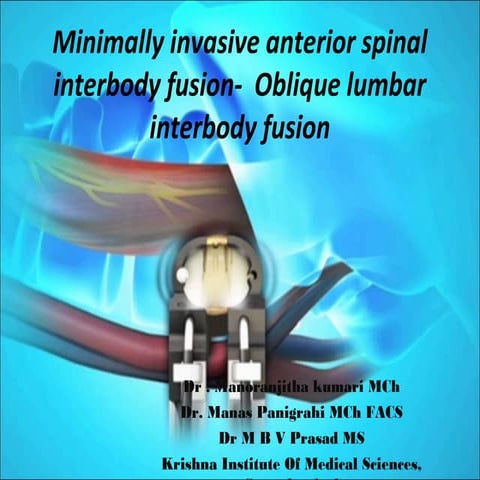 Lateral Lumbar Interbody Fusion : DLIF, XLIF with Lateral Fixation in ...