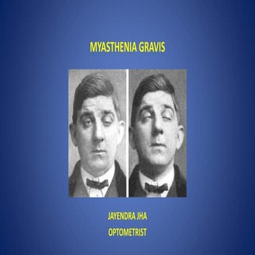 MYASTHENIA GRAVIS