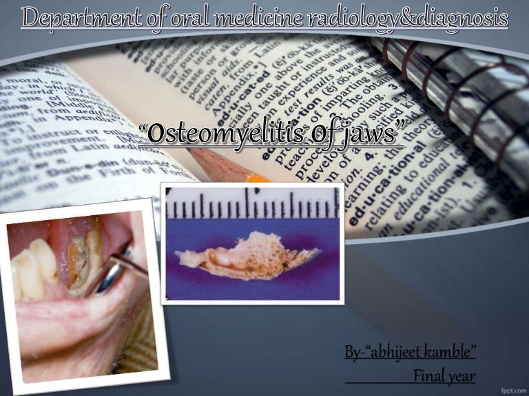 Osteomyelitis of jawdepartment of oral medicine and radiology