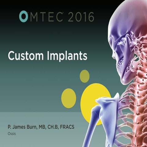 Custom Implants