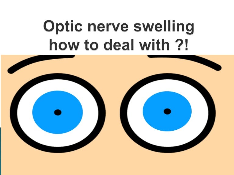 optic nerve head swelling