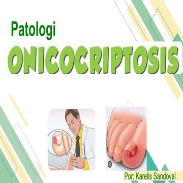 Técnica quirúrgica onicectomia complicaciones pptx | PPTX