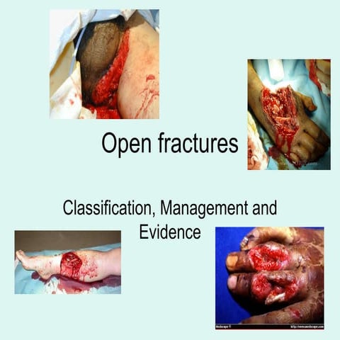 Open Fracture