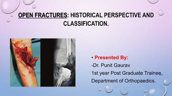 Open Fracture Antibiotics prophylaxis | PPT