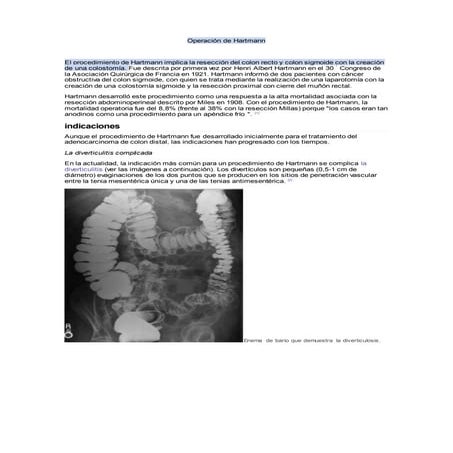 Operación de hartmann | DOCX