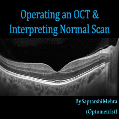 Operating an OCT & evaluating normal scan (Optom.Saptarshi Mehta).....