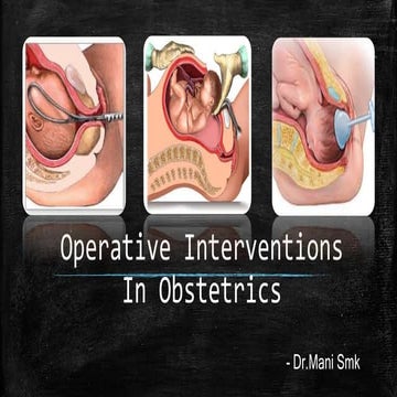 Operative Interventions In Obstetrics | PPTX