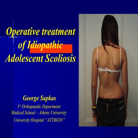 Operative treatment of Idiopathic Adolescent Scoliosis