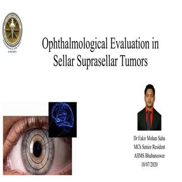 Ophthalmological evalution in sellar suprasellar tumours