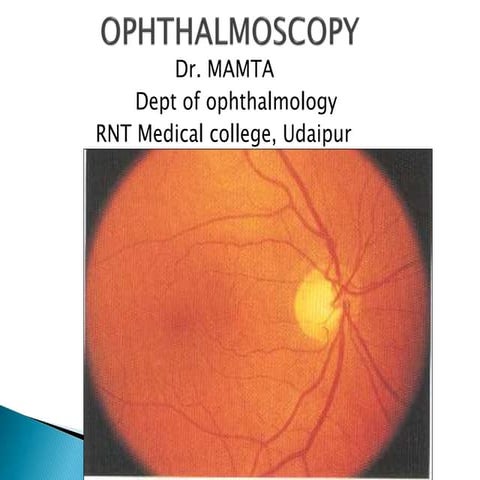 Ophthalmoscopy