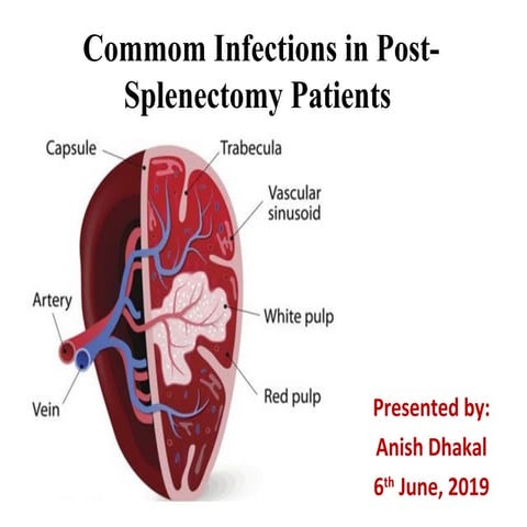 OPSI Splenectomy by Dr. Aryan