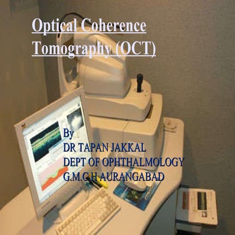 Optical coherence-tomography-120421562843883-4