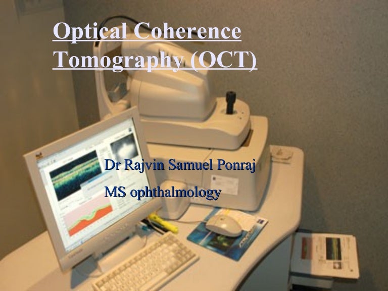 Optical coherence tomography