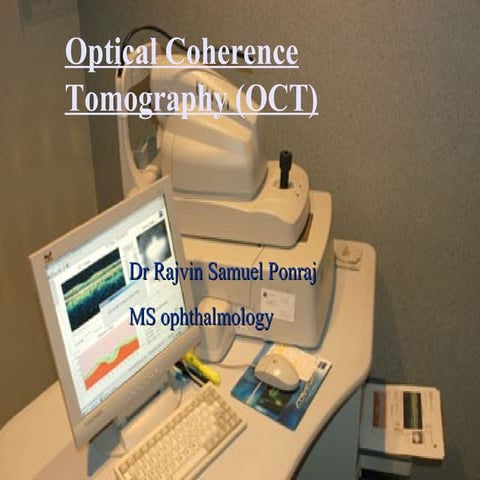 Optical coherence tomography