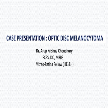 Optic disc melanocytoma