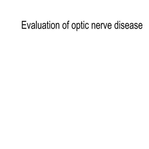 Optic nerve 2