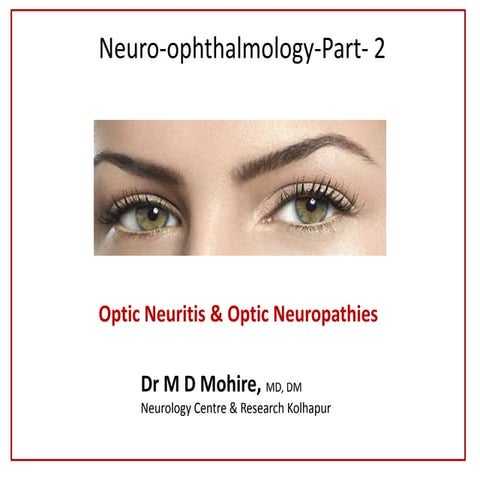 Optic neuritis.Neuroophthalmology, Teaching Slides, Dr M D Mohire, Kolhapur, ...