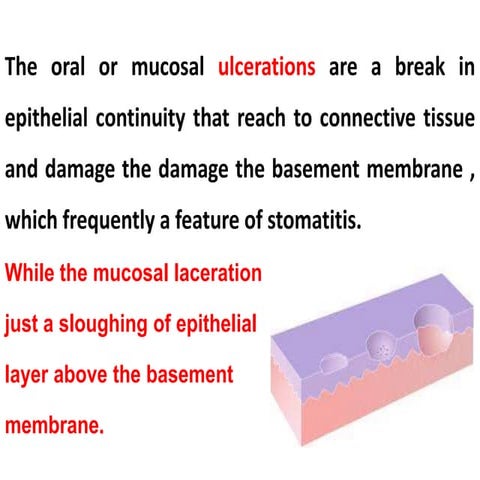 K-oral.m-Oral ulcerations