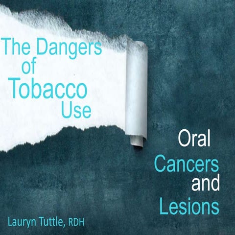 The Dangers of Tobacco Use in Oral and Systemic Health | PPTX
