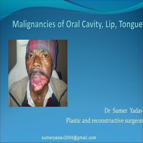Malignancies of Oral Cavity, Lip, Tongue