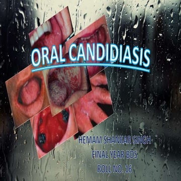 Oral Candidiasis (Poster)